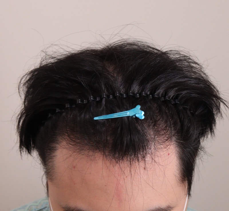 0. 수술전_2.JPG