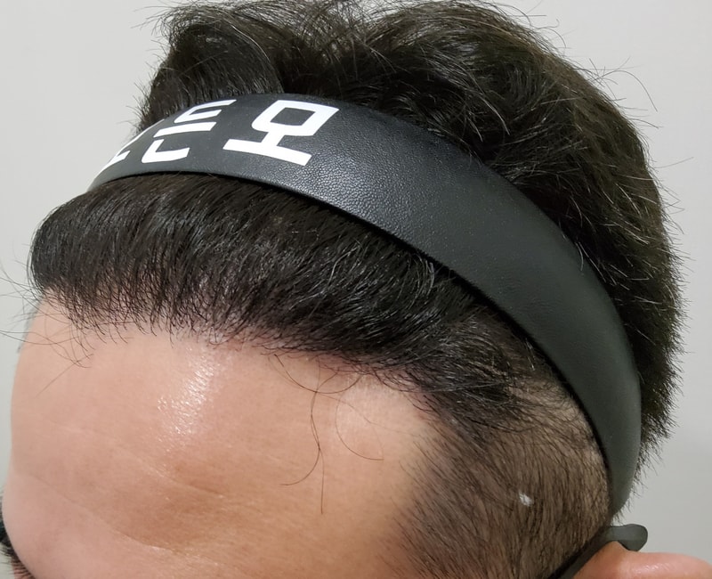4. 수술후_1년_2.jpg