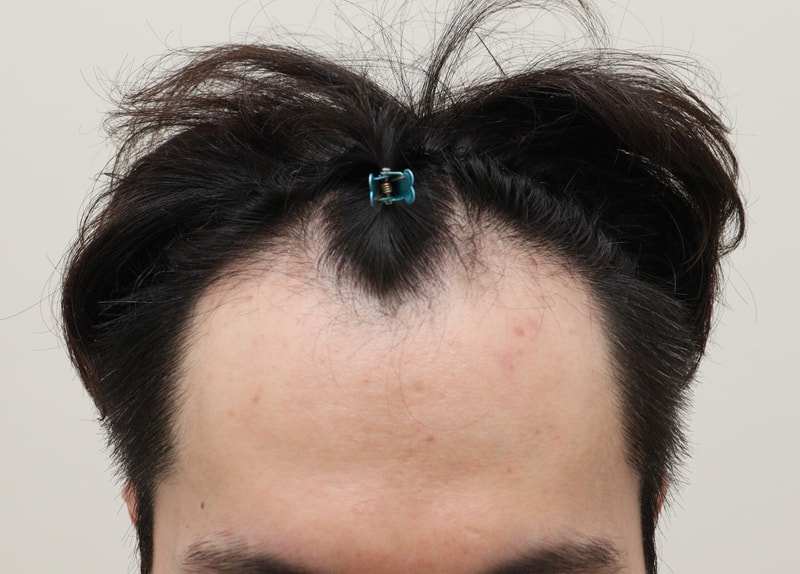 포토후기 이미지