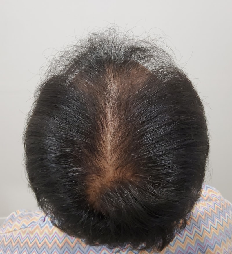 1. 수술전_3.jpg