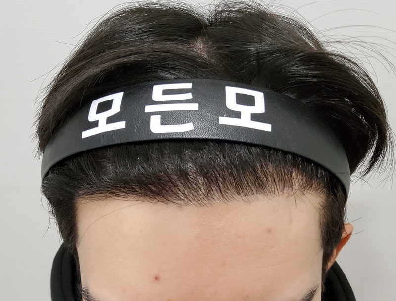 4. 수술후_6개월_1.jpg