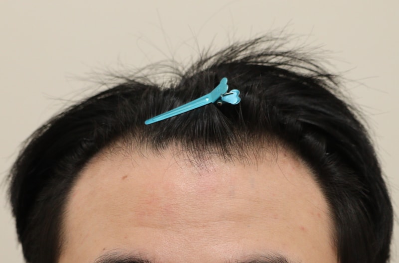 포토후기 이미지