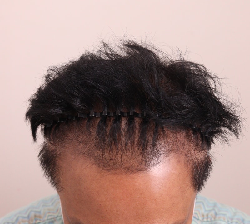 머리자라는게 너무 재밌네요^^