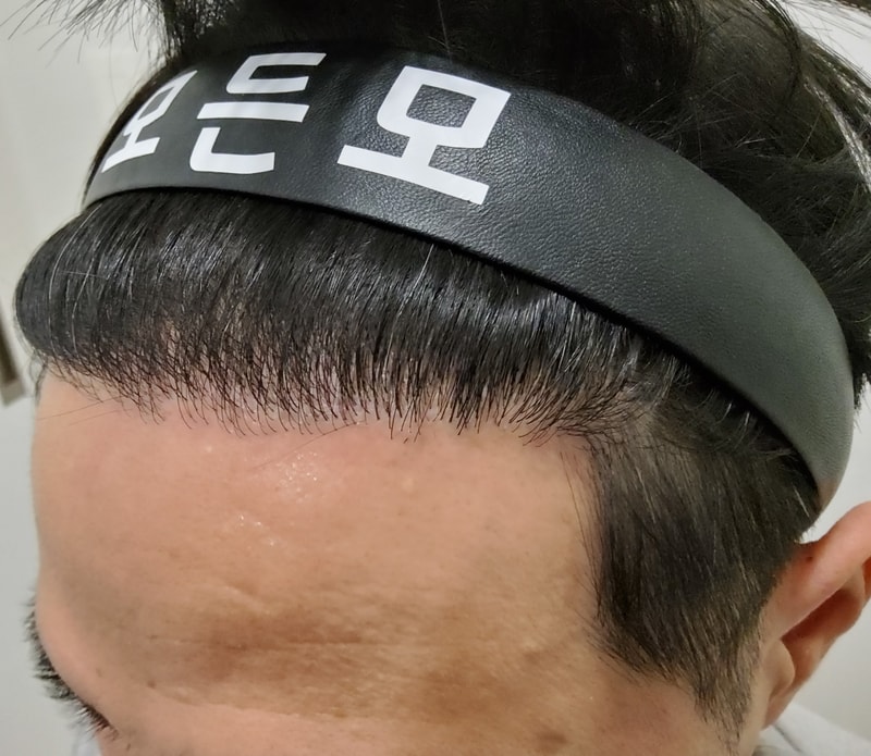 4. 수술후_1년_3.jpg