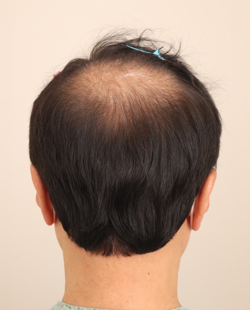 포토후기 이미지