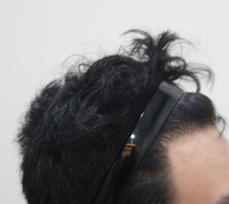 4. 수술후_7개월_2.JPG