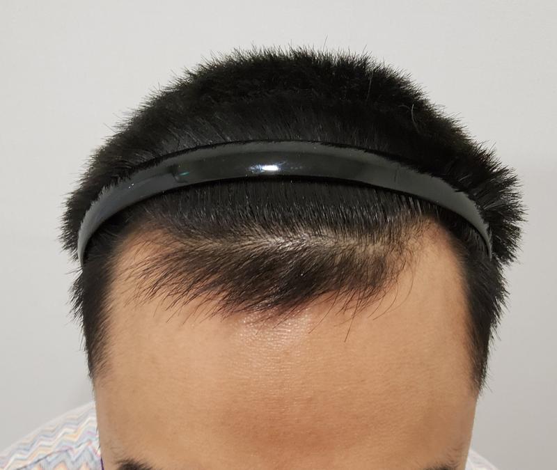 复学前修了宽阔的额头。