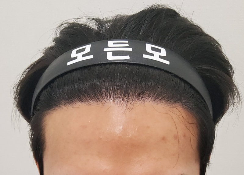 수술후_1년_1.jpg