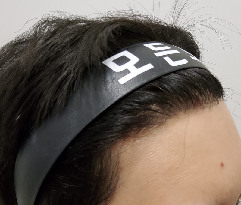 4. 수술후_6개월_3.jpg