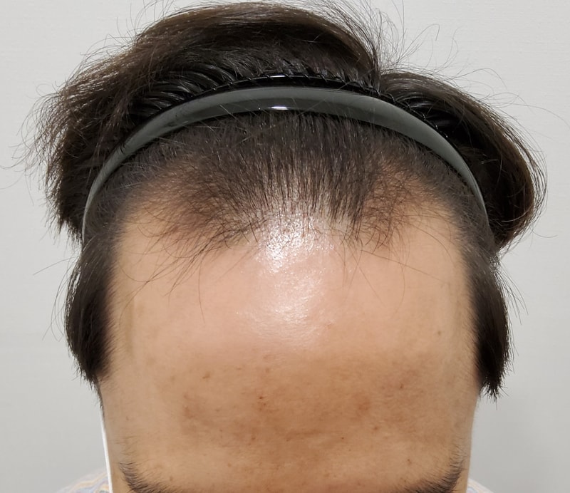 포토후기 이미지