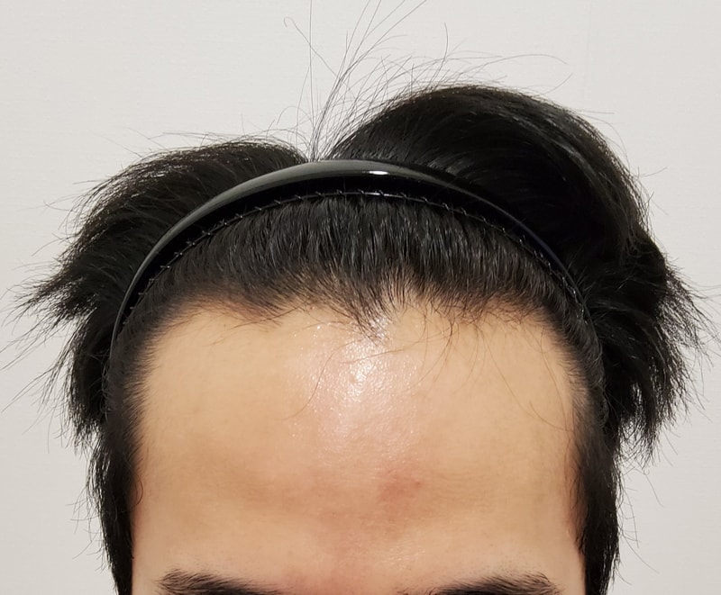 I filled in the gouretnaru too