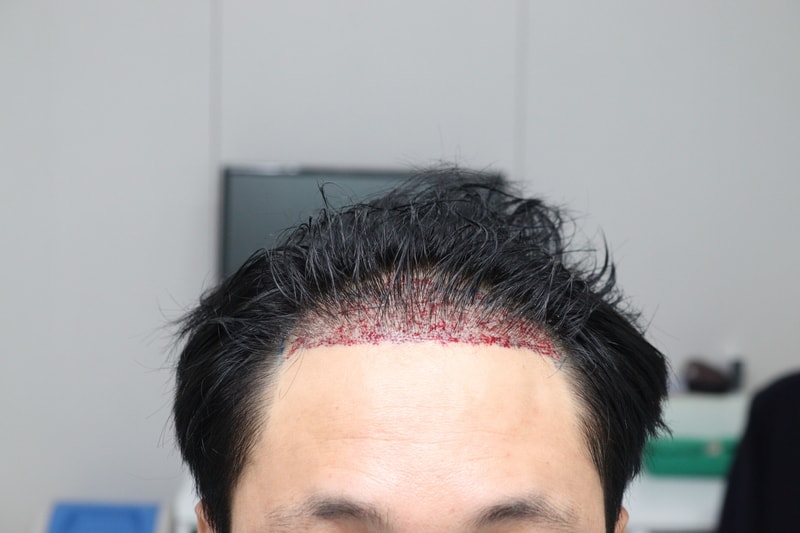 2. 수술후_당일1일.JPG