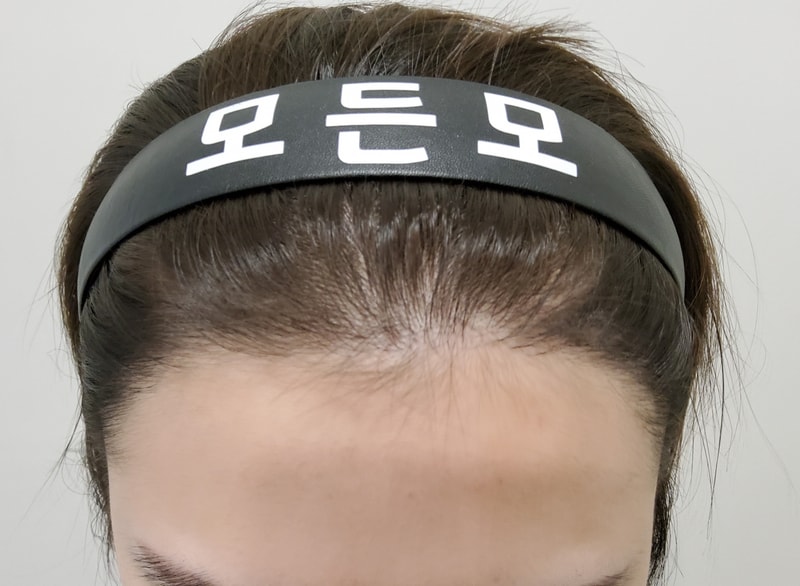 5. 수술후_1년_1.jpg