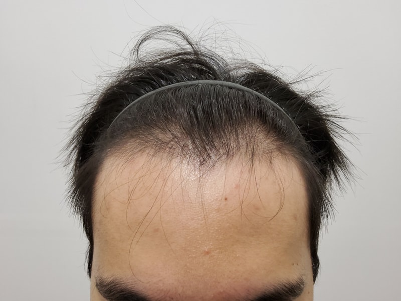 포토후기 이미지