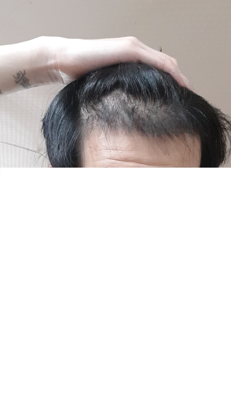 23달암흑기.jpg