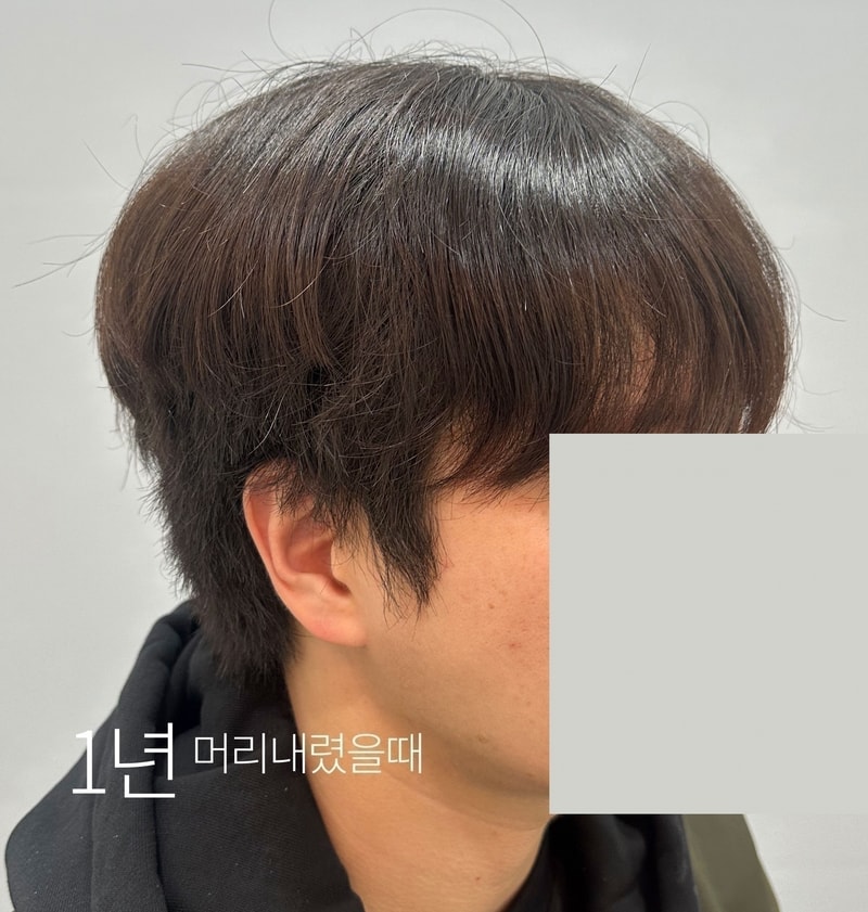 수술후_368D_3.jpg