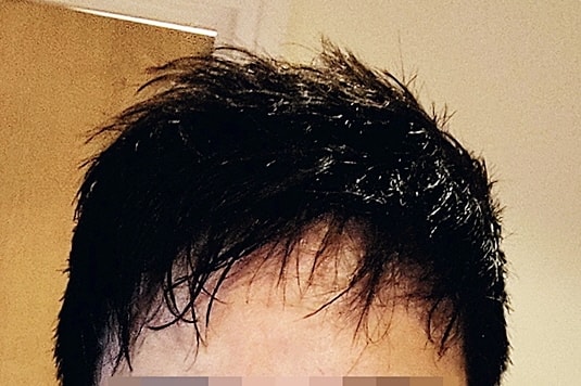 op8 months 1.jpg
