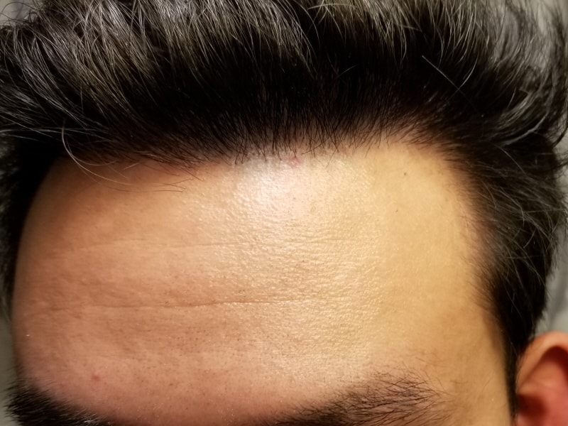 op20190903_182854-min.jpg
