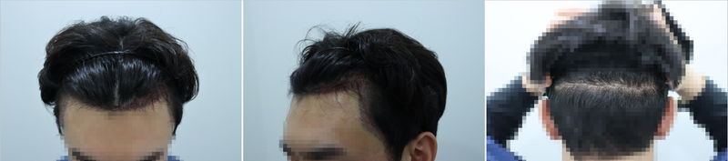 수술 다음날.png