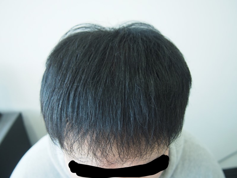 8개월차