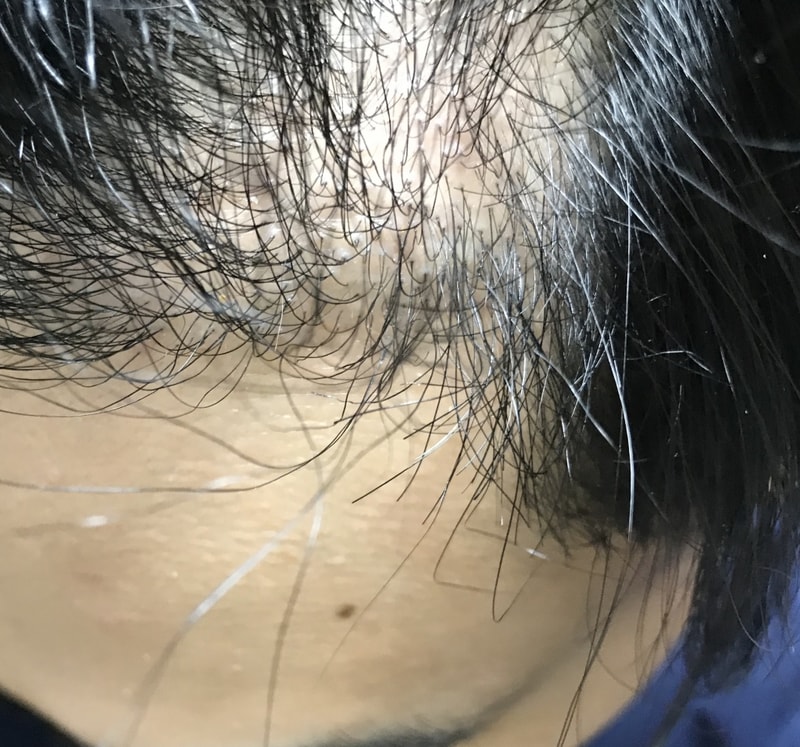 7ヶ月目···待ってろという言葉は信じられません。
