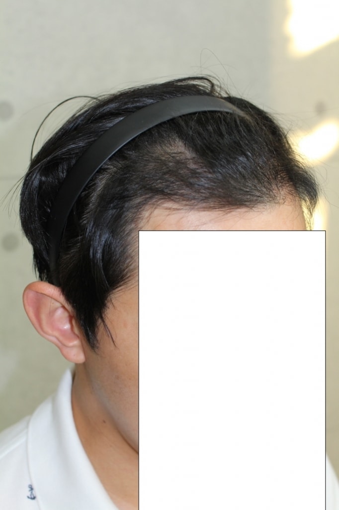 4개월후1.JPG