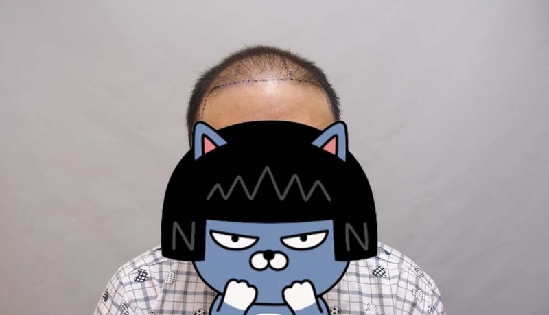 수술전_1.jpg