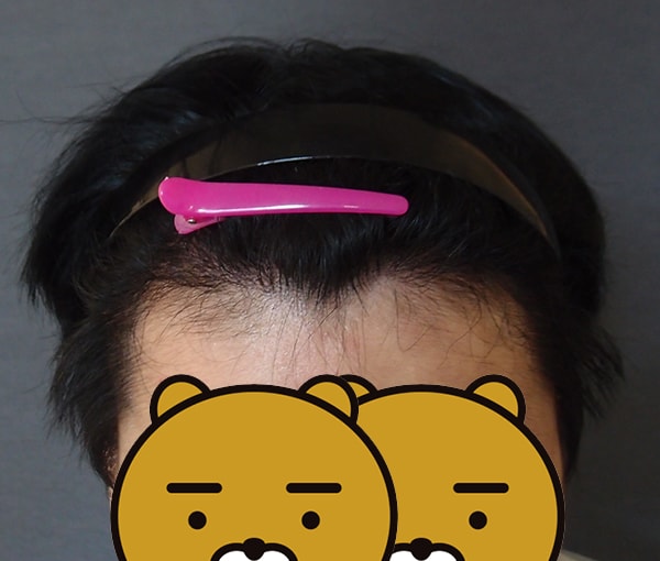 7개월차_1.jpg