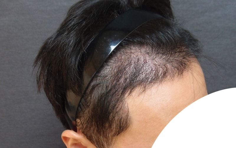 수술후3.jpg