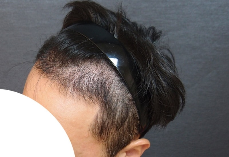 수술후2.jpg