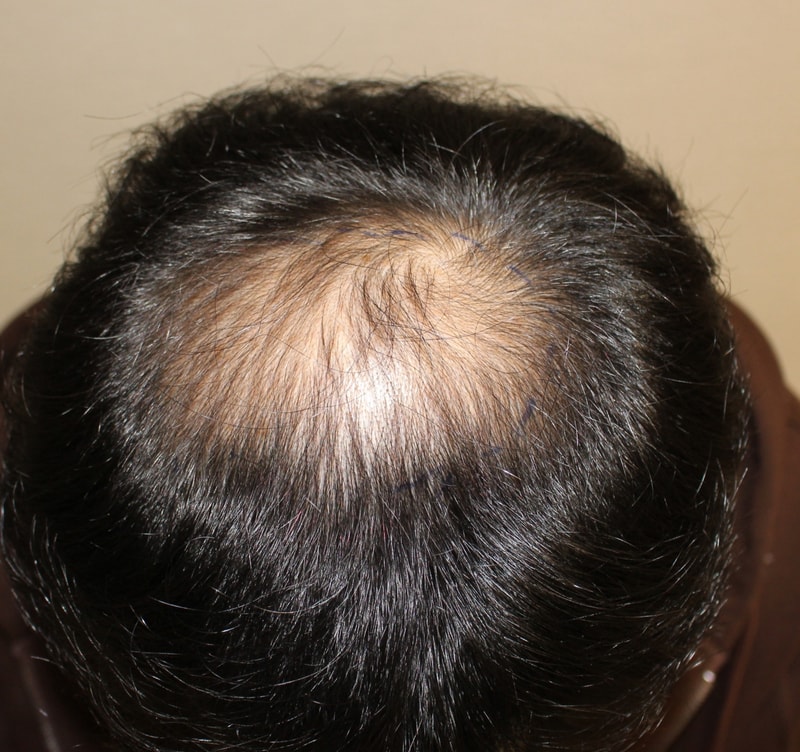 포토후기 이미지