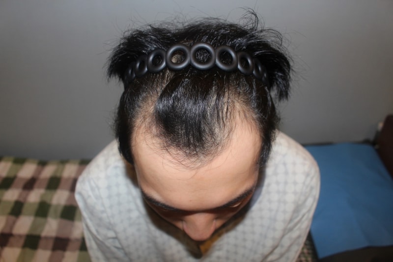 수술전.JPG