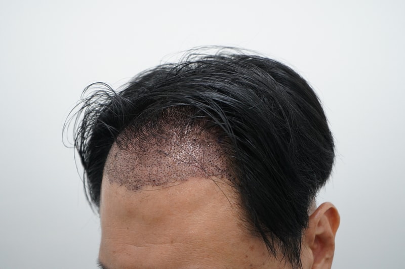 수술직후 25.JPG