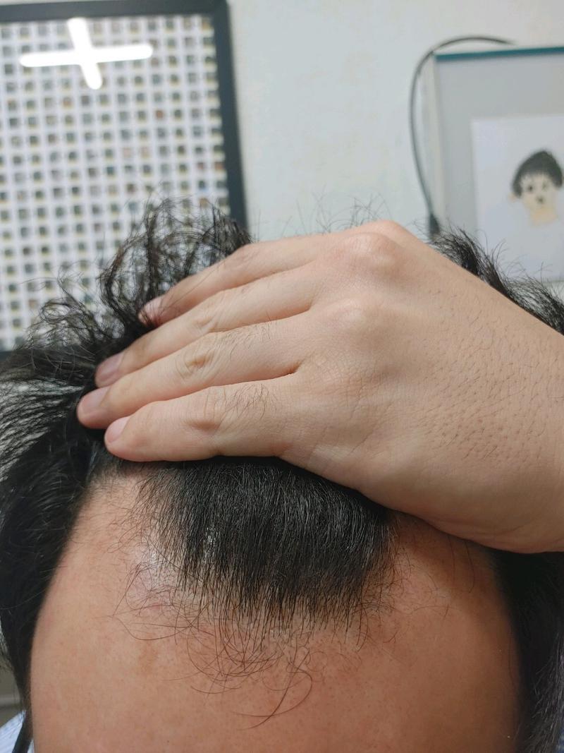 수술전.jpg
