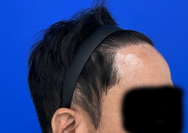 수술후 3.jpg