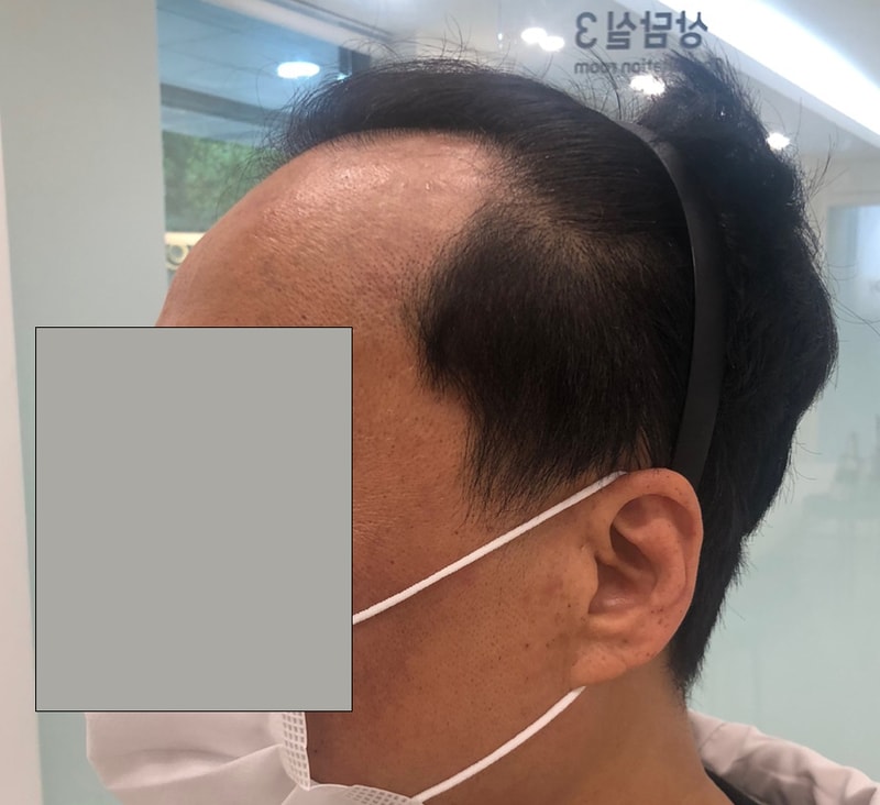 수술전 2 복사.jpg