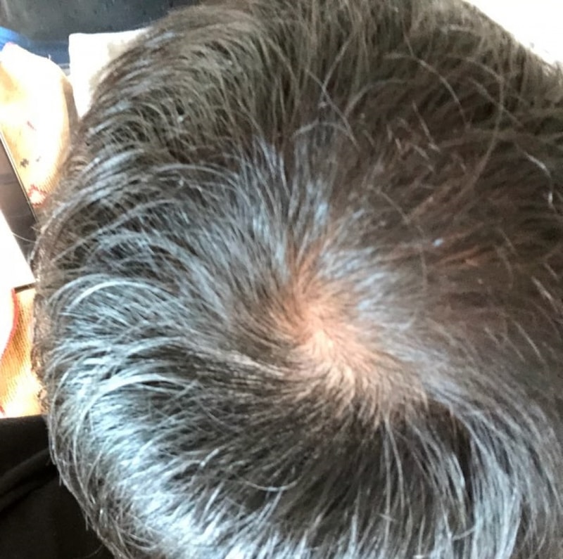 KakaoTalk_20180822_085947089.jpg