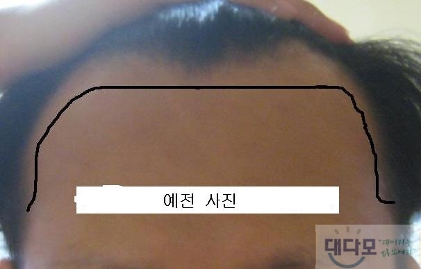 예전.jpg