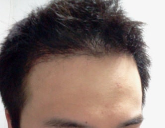 77.jpg