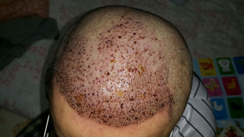 크기변환_1일뒤.jpg