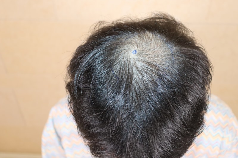 포토후기 이미지