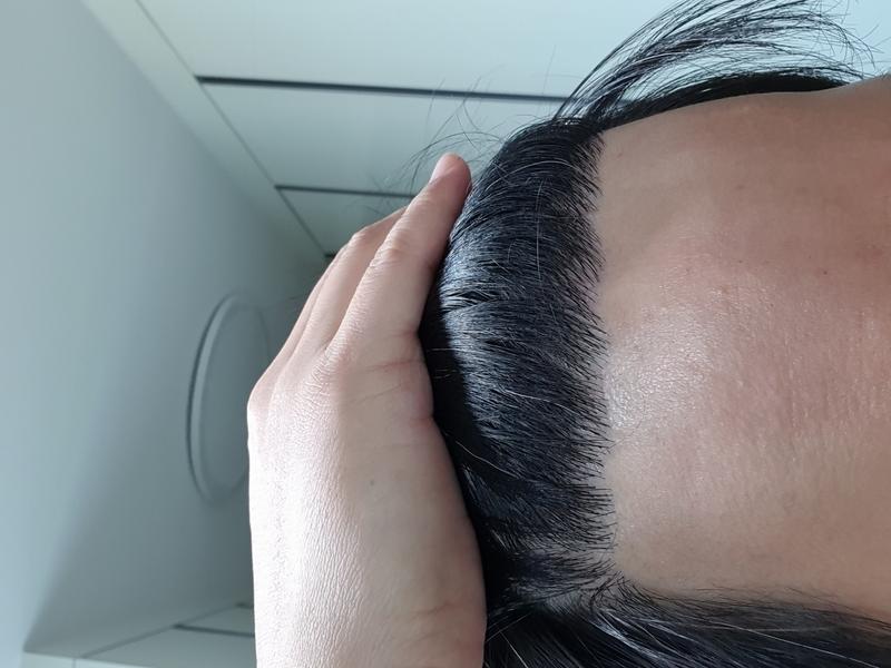 10ヶ月目です