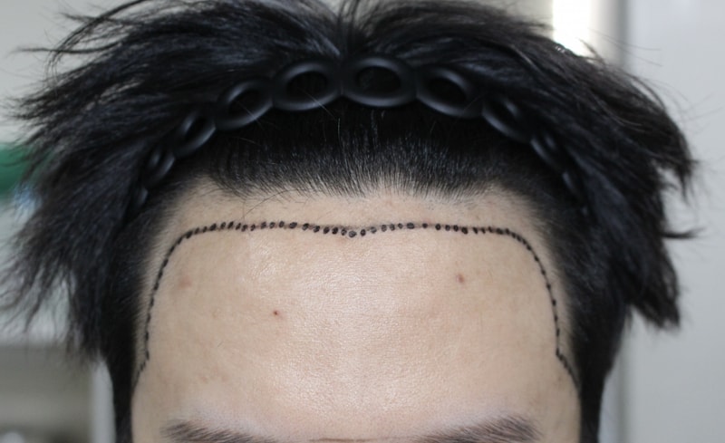 포토후기 이미지