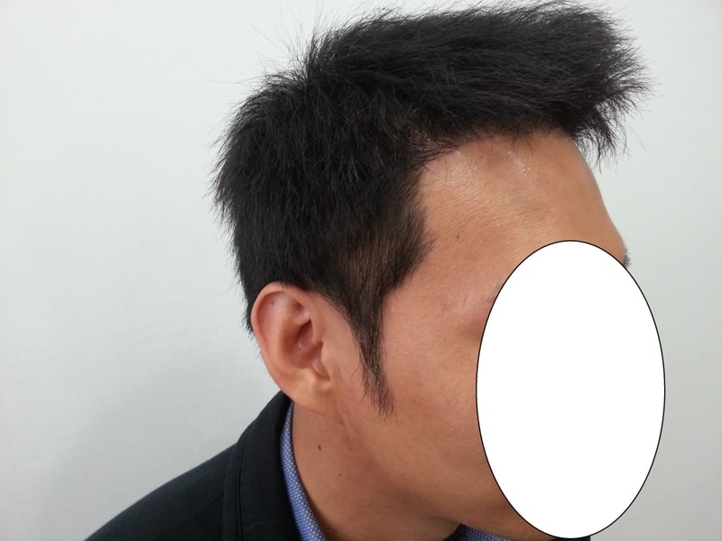 수술후1.jpg