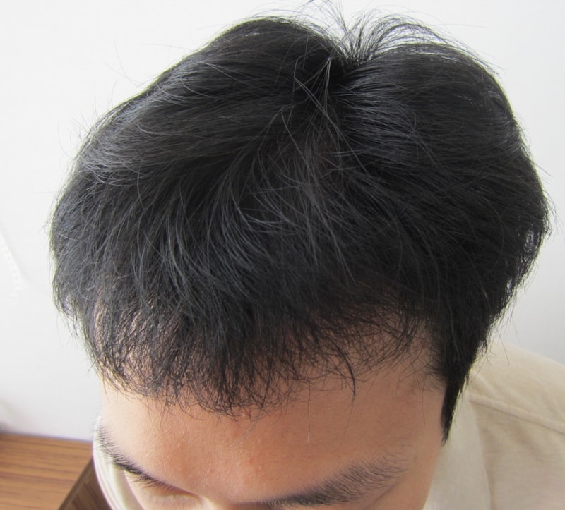 수술후5.JPG