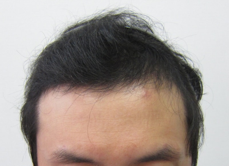 수술후1.JPG