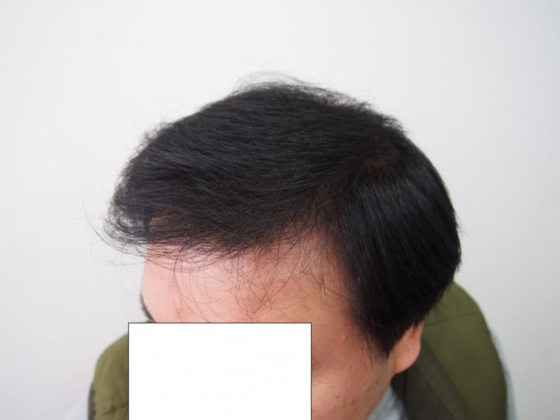 7개월4.JPG