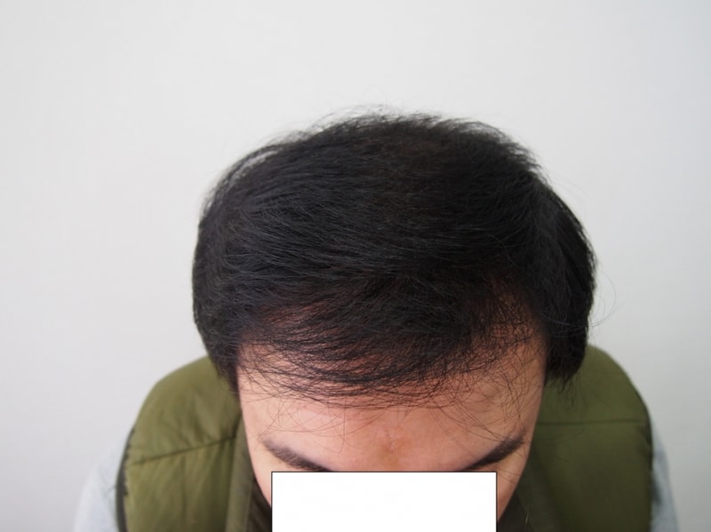 7개월1.JPG