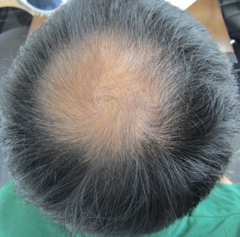 수술전.JPG