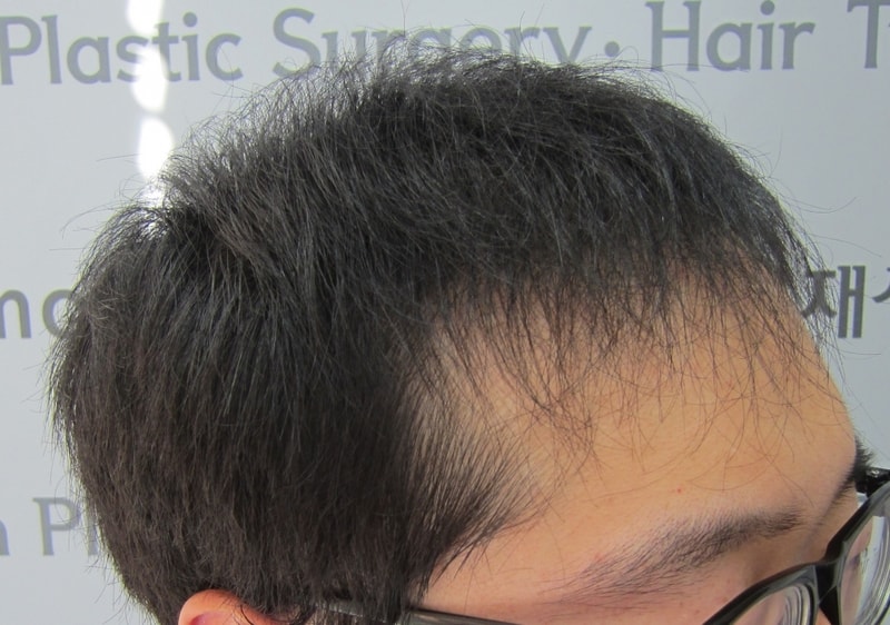수술후1.JPG